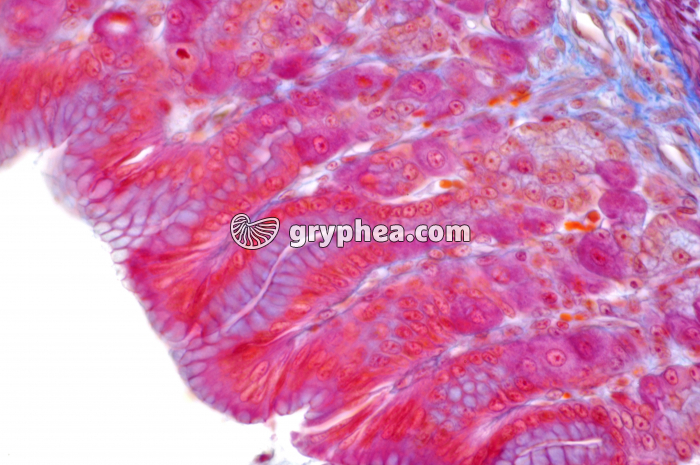 Estomac pylorique x160 - gryphea.org